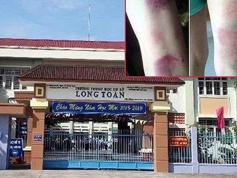 Sở GDĐT Bà Rịa-Vũng Tàu ban hành văn bản vụ cô giáo đánh học sinh bầm tím