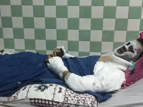 Vụ Việt kiều Canada bị tạt axit, cắt gân chân: Hé lộ chân dung 2 nghi can