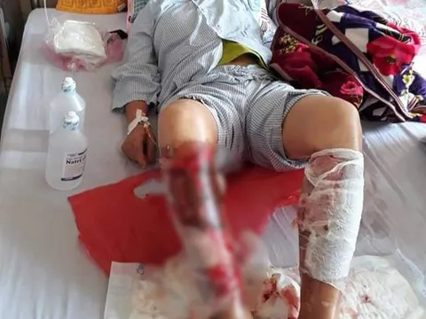 Truy bắt 2 người đổ chất thải độc ra mương khiến người dân bỏng nặng