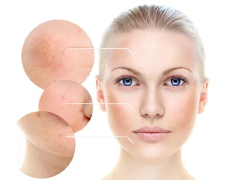 8 con số kỉ lục khó có sự kiện thẩm mỹ nào sánh kịp như 'Melas Ruby - Cách mạng trị nám 4.0'