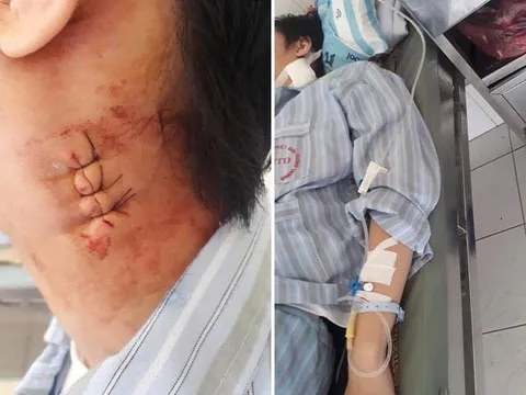 Hà Nội: Bác sĩ Bệnh viện Bạch Mai 'mổ nhầm' gây biến chứng cho bệnh nhân?