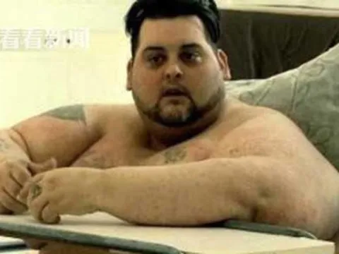 Giảm cân sai cách, người đàn ông 300kg qua đời