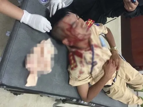 Người đàn ông cầm đá tấn công đại úy CSGT nhập viện từng có 2 tiền án