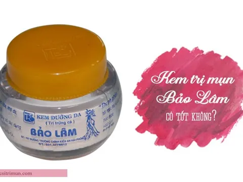 Đình chỉ hàng loạt kem ngừa mụn chứa thành phần không được cấp phép