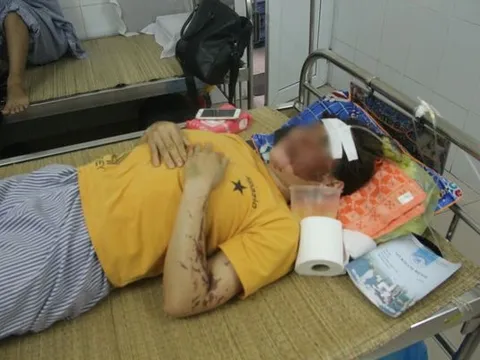 Hé lộ động cơ gây án của kẻ chủ mưu vụ tạt axit nữ phụ bếp tại Hòa Bình