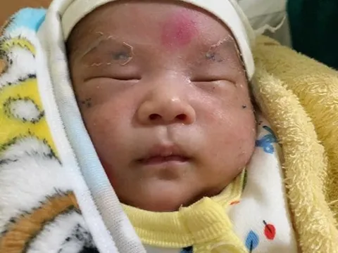 Nam Định: Bé trai 10 ngày tuổi bị mẹ trẻ 16 tuổi bỏ rơi