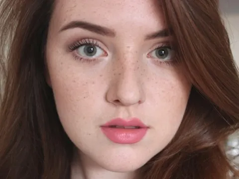 Tàn nhang và những điều cần biết về cách chữa trị