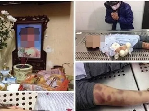 Chủ tịch Hà Nội chỉ đạo điều tra vụ bé 3 tuổi nghi bị mẹ và bố dượng bạo hành tử vong