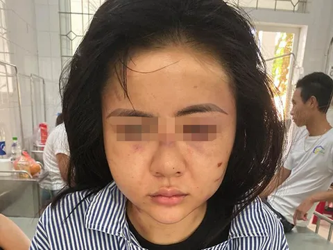 Triệu tập gã thanh niên xăm trổ hành hung cô gái suốt 2 giờ ở Yên Bái