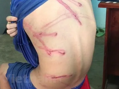 Nguyên nhân bé trai 12 tuổi bị bố dùng dây điện đánh dã man ở Bình Phước