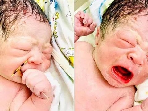 Thực hư hình ảnh em bé chào đời cầm vòng tránh thai trên tay ở Hải Phòng