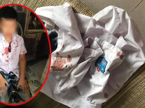 Tạm giữ phụ huynh xông vào trường hành hung học sinh lớp 1 nhập viện