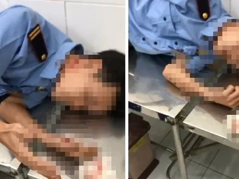 Truy tìm kẻ đâm trọng thương 3 bảo vệ chung cư ở quận 12