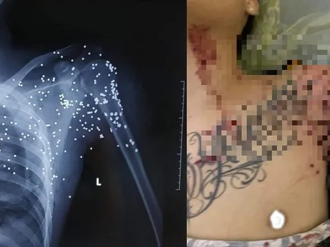 Bắt nghi phạm trong vụ nổ súng tại Trạm thu phí Thanh Nê Thái Bình