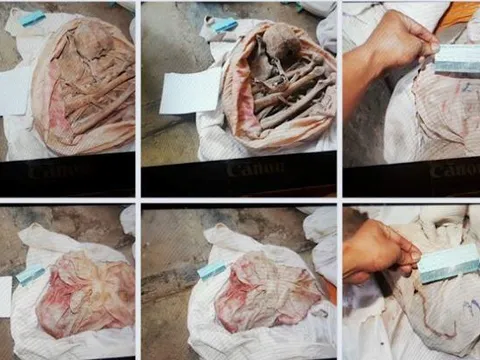 Phát hiện thêm 7 bộ xương người trong vườn cao su ở Tây Ninh