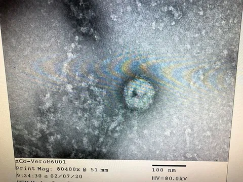 Việt Nam nuôi cấy và phân lập thành công virus corona mới