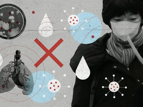 Thêm dấu hiệu đặc trưng của người nhiễm virus corona