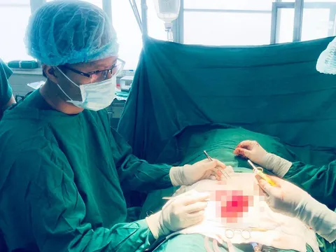 Mâu thuẫn tình cảm, vợ dùng kéo cắt đứt 'của quý' của chồng lúc ngủ say