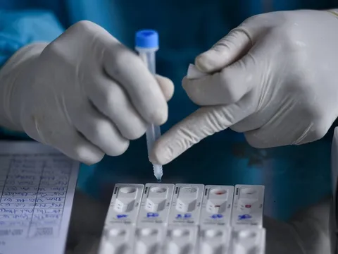 TP.HCM chủ trương cho người dân tự test nhanh với COVID-19 tại nhà