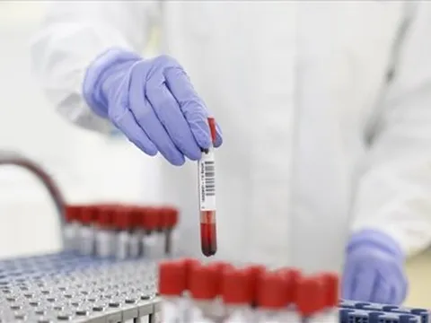 Hà Nội ghi nhận thêm 26 ca dương tính với SARS-CoV-2 vào trưa 12/8