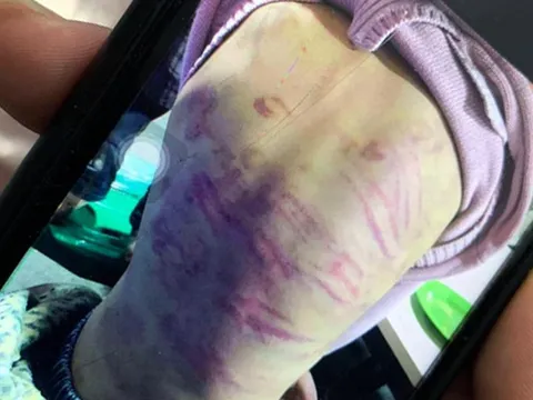 Vụ bé gái ở Hà Nội bị người tình của mẹ xâm hại: Yêu râu xanh xâm hại 9 lần