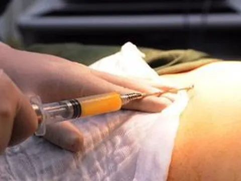 TP.HCM: Nữ bệnh nhân tử vong sau 14 tiếng hút mỡ bụng