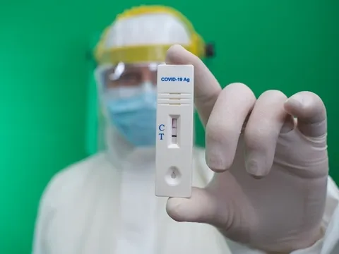 TP.HCM thanh tra, kiểm tra đột xuất việc mua bán kit xét nghiệm