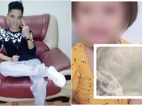 Vụ bé 3 tuổi bị găm 9 đinh vào đầu: Lạnh người những trận đòn roi của gã người tình