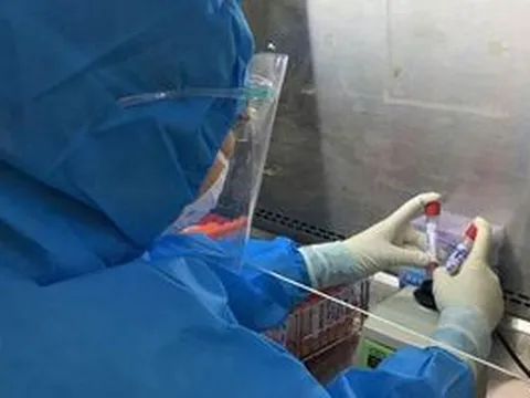 Ngày 27/1: Cả nước có 15.727 ca mắc COVID-19, Hà Nội tiếp tục nhiều nhất, hơn 2.900 F0