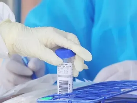 Ngày 29 Tết, có 12.674 ca COVID-19 tại 57 tỉnh, thành; giảm hơn 1.000 ca so với hôm qua