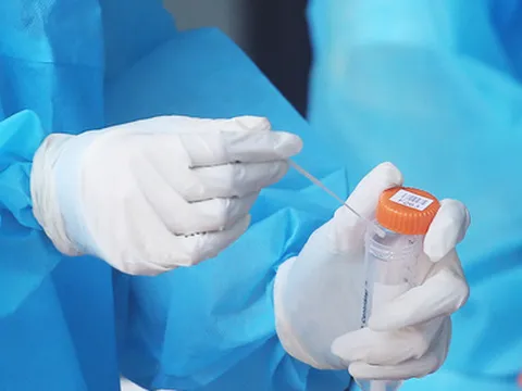 Ngày 22/2: Số mắc COVID-19 mới tăng vọt lên 55.879 ca; F0 tử vong giảm còn 77 ca