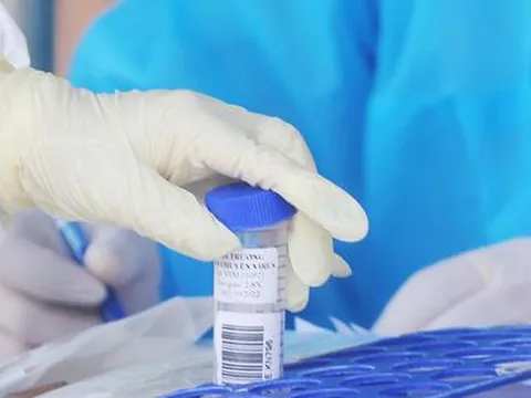 Ngày 27/2: Số mắc COVID-19 mới tăng vọt lên 86.990 ca; Phú Thọ đăng ký bổ sung 14.838 F0