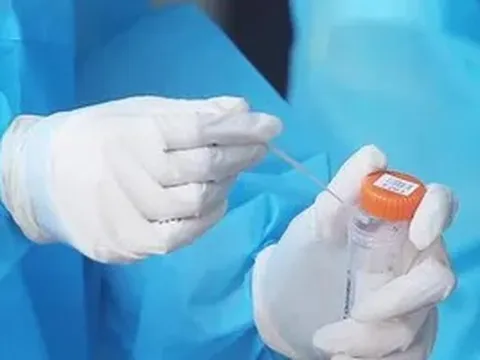 Ngày 14/3: Có 161.262 ca mắc COVID-19 mới; 4 tỉnh bổ sung hơn 103.000 F0