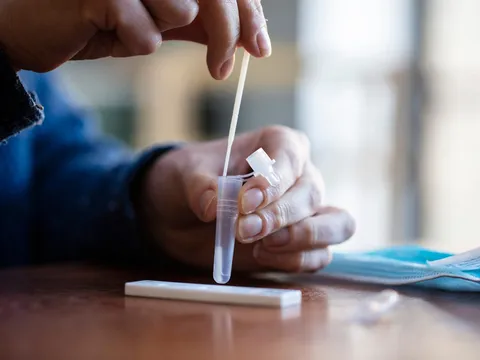 Có hay không nguy cơ ngộ độc từ dung dịch đệm của kit test nhanh COVID-19?