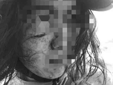 Khởi tố người đàn ông chặn đường rạch mặt vợ