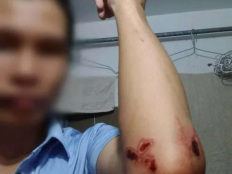 Điều tra vụ tài xế GrabBike bị đánh đập dã man ở gần bến xe Miền Tây