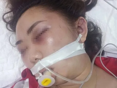 Cô gái 22 tuổi tử vong, nghi bị bạn trai đánh