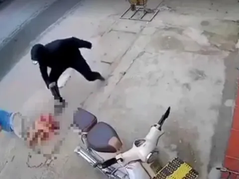 Người đàn ông bị chém đứt lìa chân khi đang đi bộ trên đường