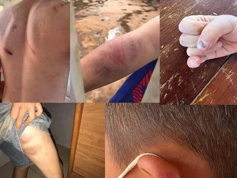 Khởi tố cha và bà nội bạo hành cháu bé 9 tuổi ở Đắk Lắk