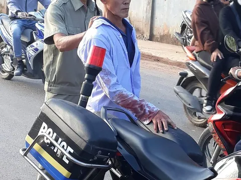 Điều tra vụ án mạng trước công ty ở Bình Dương khiến 2 người thương vong