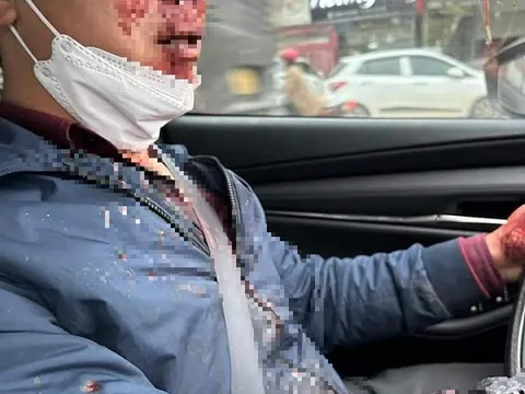 Khởi tố đối tượng hành hung giáo viên để cướp tài sản