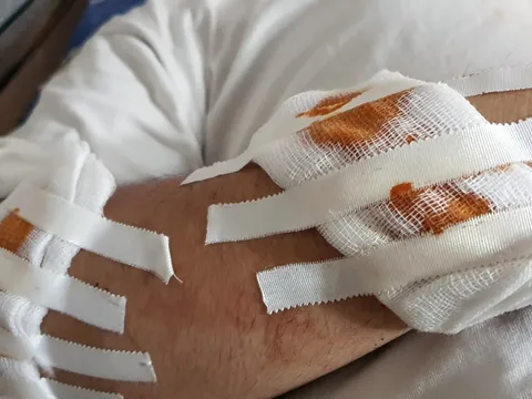 Điều tra nhóm đối tượng chém người đi đường lúc rạng sáng ở Hà Nội