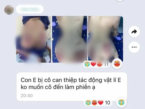 Hà Nội: Xác minh thông tin cháu bé 9 tuổi nghi bị cô giáo dạy can thiệp bạo hành
