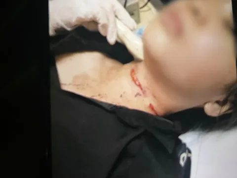 Bình Dương: Cô gái tự cắt cổ rồi báo bị tấn công, cướp tài sản