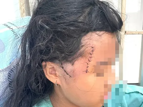 Đồng Nai: Tạm giữ 'chồng hờ' chém mẹ con người tình bị thương