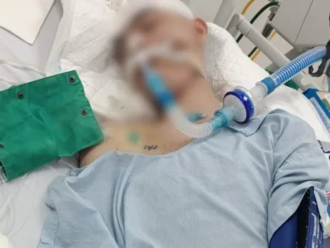 Khởi tố, bắt tạm giam thiếu niên đánh nam sinh lớp 8 chết não