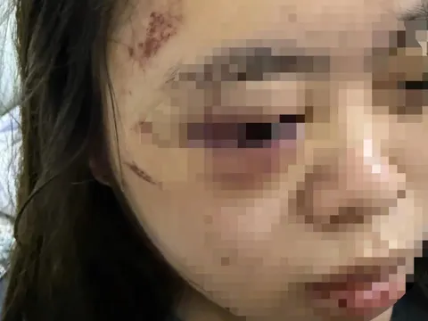 Triệu tập 3 đối tượng trong vụ thiếu nữ bị đánh hội đồng ở Hà Nội